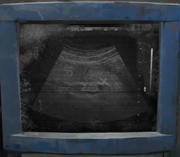 纸嫁衣8千子树正版