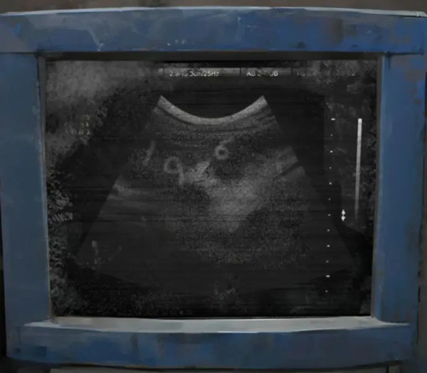 纸嫁衣8千子树正版